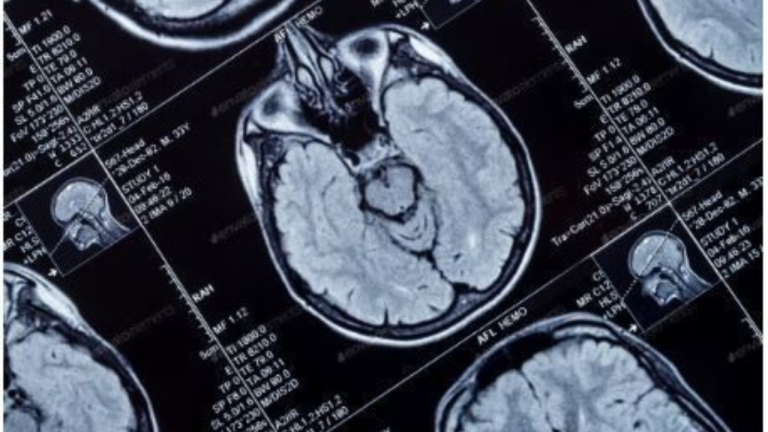 VACANCIES FOR ADULT NEUROLOGISTS